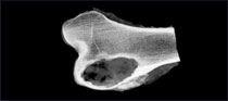 medical x-ray image bone