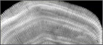 x-ray image coral