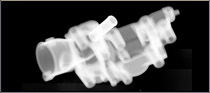Materialkontrolle Röntgenbild Aluminium Gussteil 3